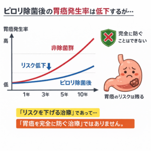 ピロリ菌と胃癌の関係性と胃癌検診の大切さ